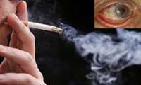 مصرف سيگار و ضعف بينايي