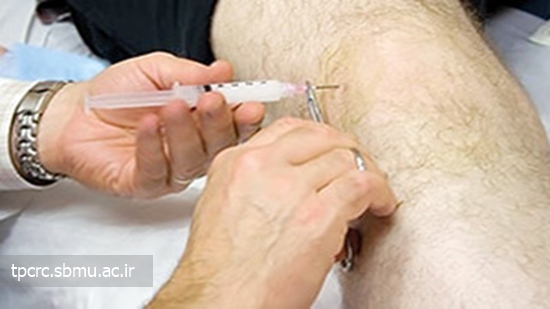 سيگار و آرتروز، 