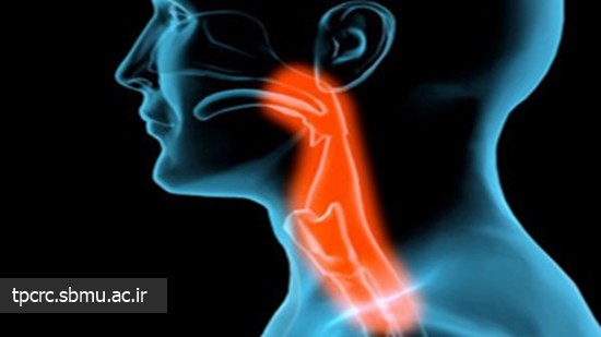 مصرف مداوم سيگار و سرطان حنجره، 