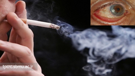 مصرف سيگار و ضعف بينايي 