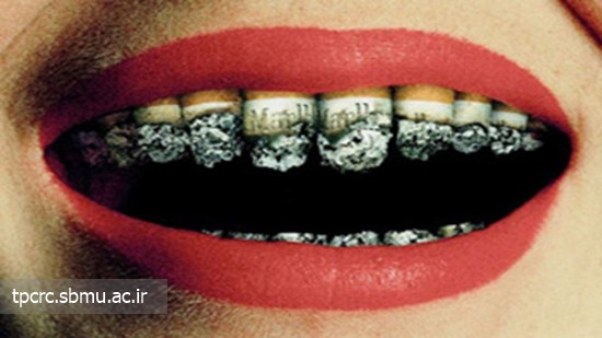 ايمپلنت و سيگار، 