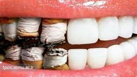 رابطه سیگار با بیماری‌های دهان و دندان 