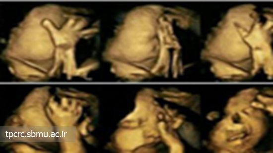 عکس‌های تکان‌دهنده از اثر سیگار بر جنین 