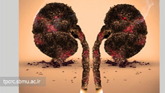 سيگار و سرطان كليه، 