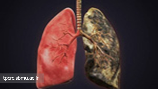 سيگار كشيدن و ريه، 