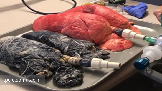 مقايسه ريه سيگاري، 