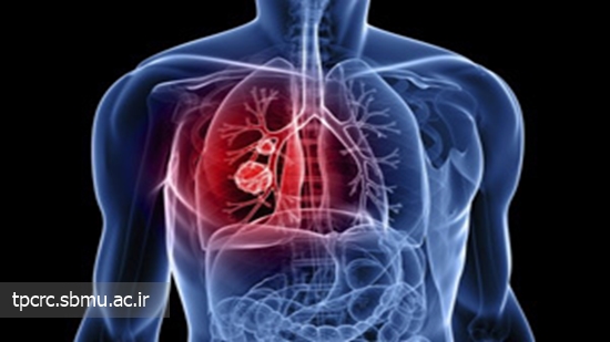 سزطان ريه، افراد سيگاري، 