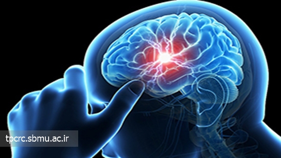 سیگار و سکته مغزی، 