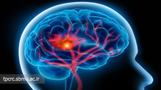 خونريزي مغزي در زنان سيگاري 